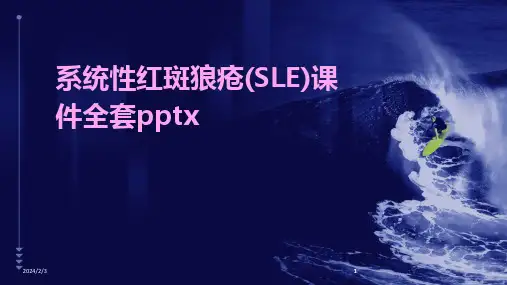 2024版年度系统性红斑狼疮(SLE)课件全套pptx