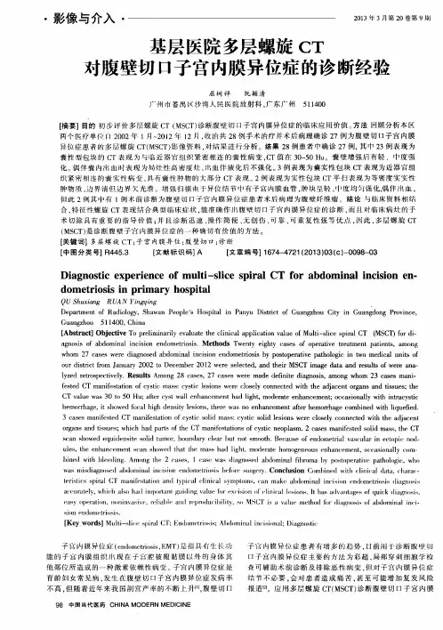 基层医院多层螺旋CT对腹壁切口子宫内膜异位症的诊断经验