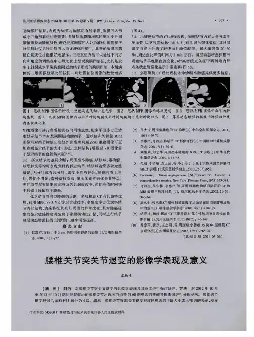 腰椎关节突关节退变的影像学表现及意义