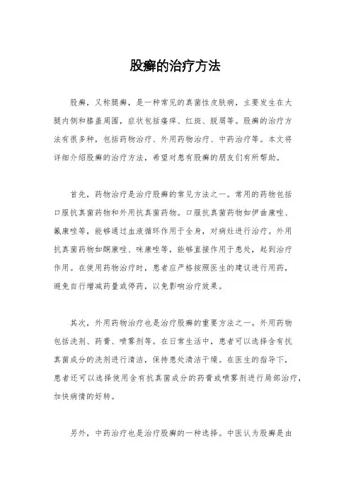 股癣的治疗方法