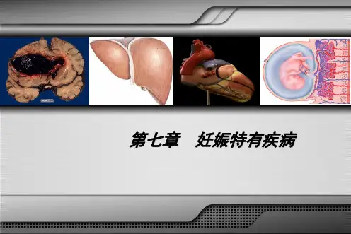 妊娠剧吐ppt课件