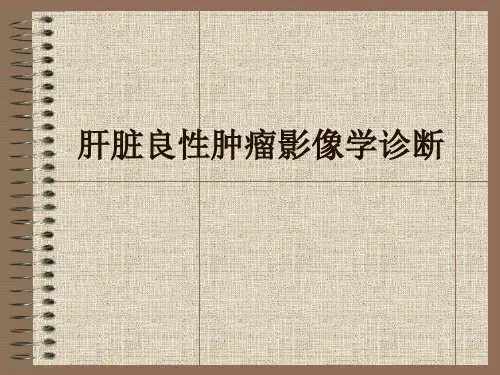 肝脏良性肿瘤影像学诊断ppt课件