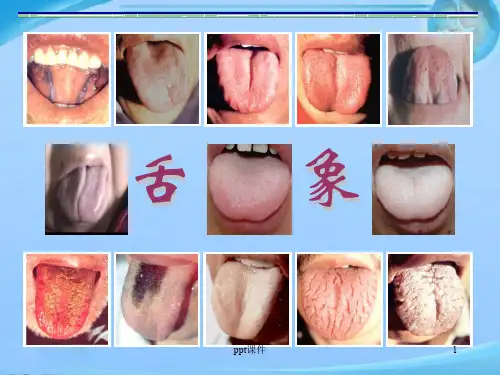 中医舌诊  ppt课件