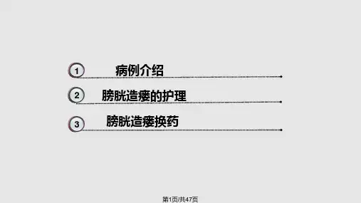 膀胱造瘘的护理查房PPT课件