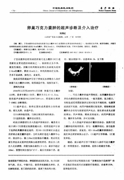 卵巢巧克力囊肿的超声诊断及介入治疗
