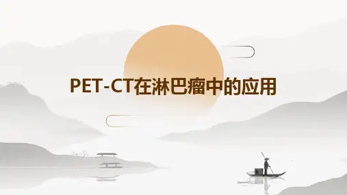 PETCT在淋巴瘤中的应用
