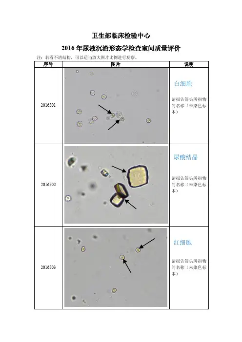 2016年尿液沉渣形态学检查室间质量评价