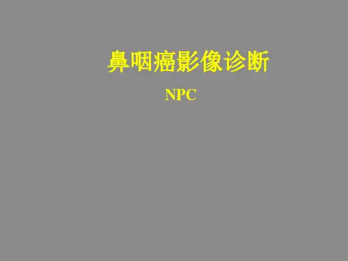 鼻咽癌影响诊断及咽旁间隙解剖(1)