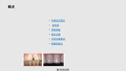 光固化复合树脂充填术PPT课件