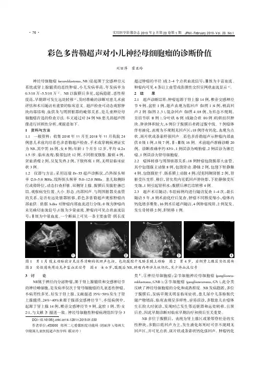 彩色多普勒超声对小儿神经母细胞瘤的诊断价值