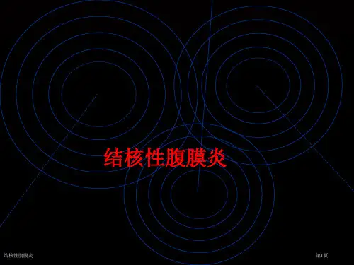 结核性腹膜炎