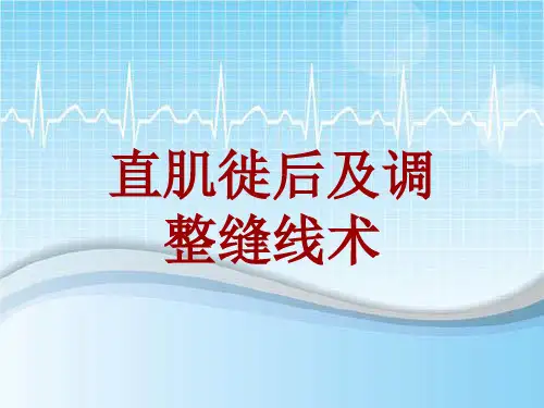 手术讲解模板：直肌徙后及调整缝线术