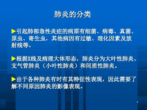 肺炎的X线表现和鉴别诊断优秀课件