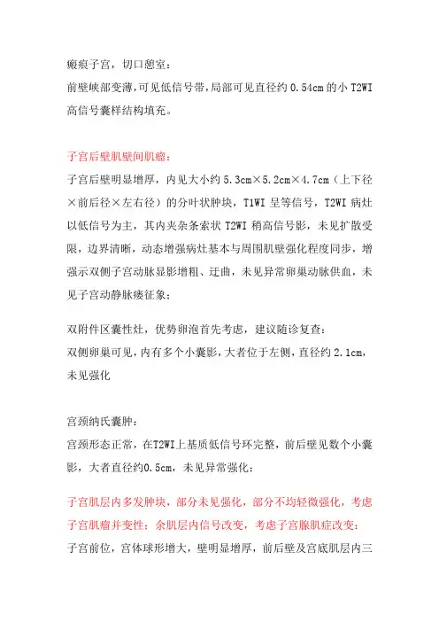 妇幼MR影像子宫肌瘤、腺肌瘤报告描述语言