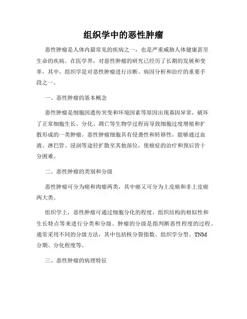 组织学中的恶性肿瘤