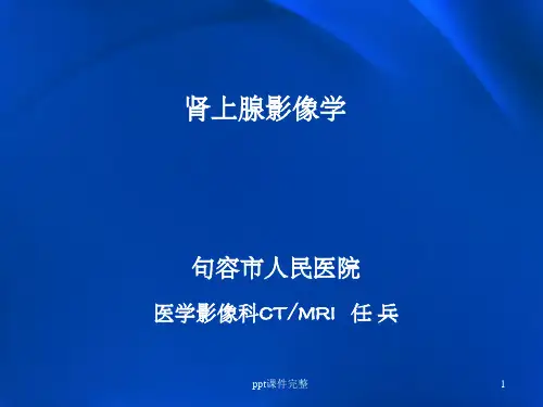 肾上腺常见疾病影像学ppt课件