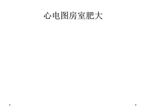 心电图房室肥大