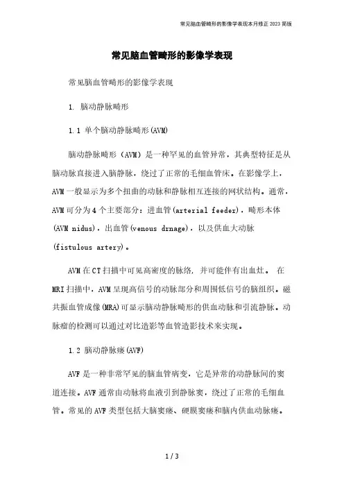 常见脑血管畸形的影像学表现本月修正2023简版