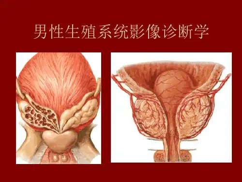生殖系统疾病课件
