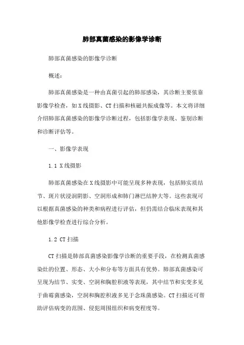 肺部真菌感染的影像学诊断
