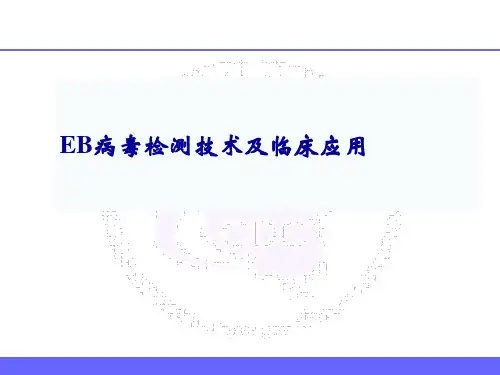 EB病毒检测技术进展及临床应用
