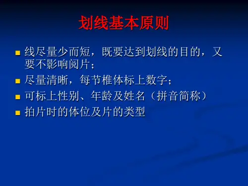 脊柱疾病x光片划片要求 新 ppt课件