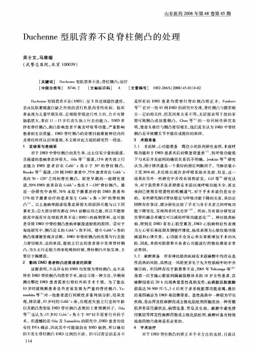 Duchenne型肌营养不良脊柱侧凸的处理