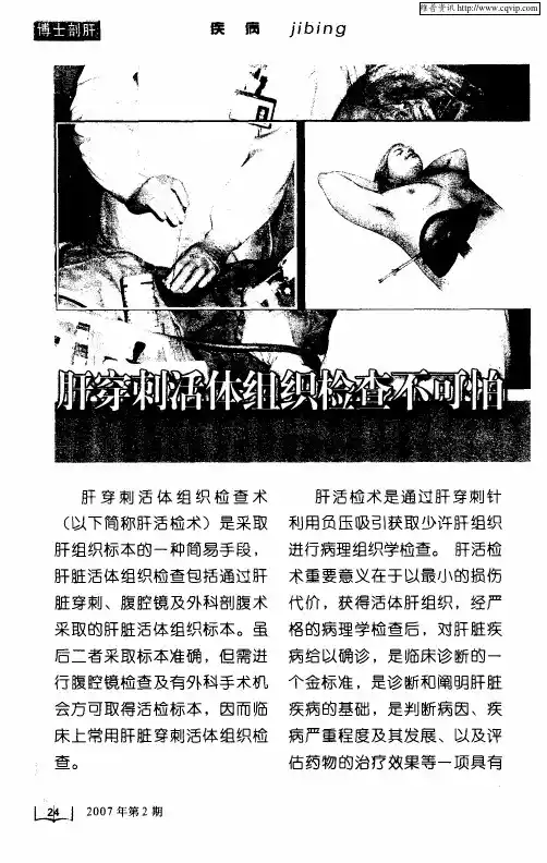 肝穿刺活体组织检查不可怕