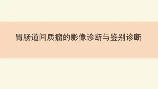 胃肠道间质瘤的影像诊断与鉴别诊断