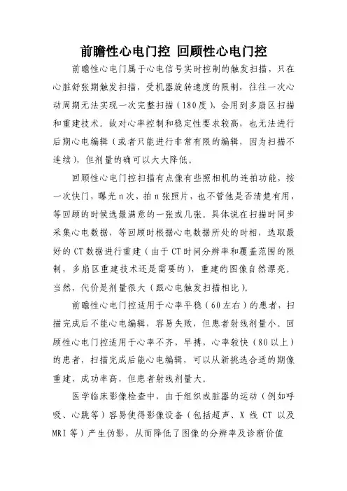 心电门控——精选推荐