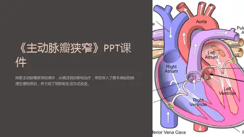 《主动脉瓣狭窄》课件