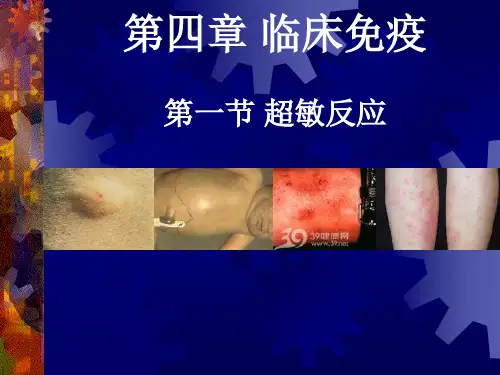 第一节 1型超敏反应