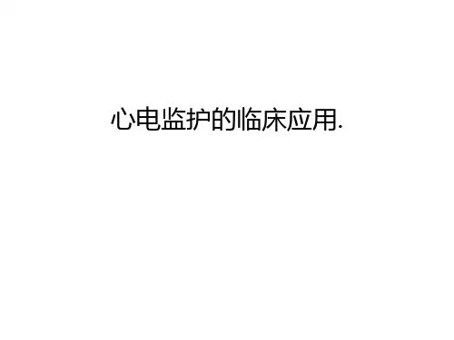 心电监护的临床应用.资料讲解