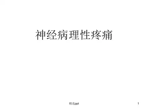 神经病理性疼痛ppt课件