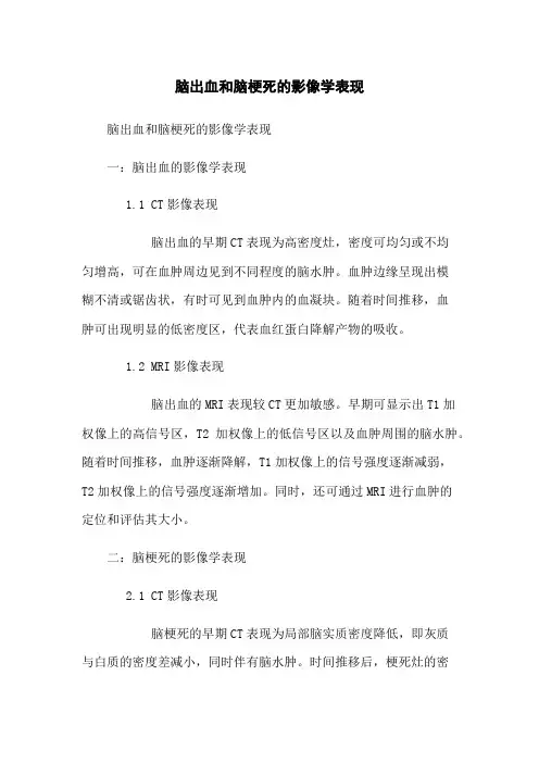 脑出血和脑梗死的影像学表现