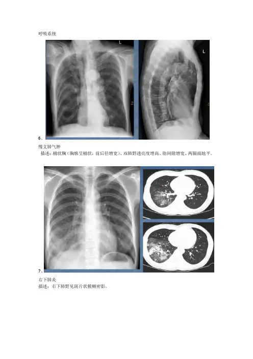 呼吸系统影像学