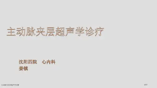 主动脉夹层的超声学诊断