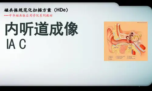 (推荐课件)MRI内听道规范化扫描方案