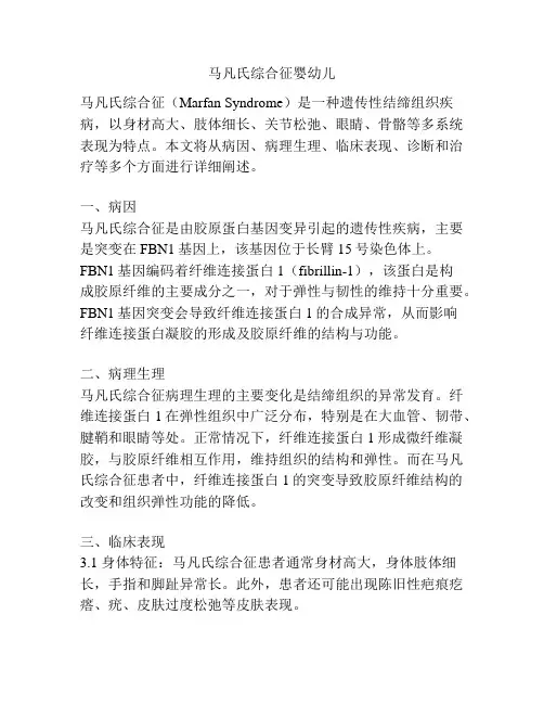 马凡氏综合征婴幼儿