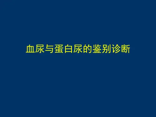 血尿蛋白尿.ppt