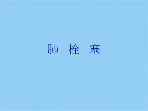 肺   栓   塞(共41张PPT)