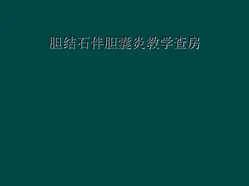胆结石伴胆囊炎教学查房