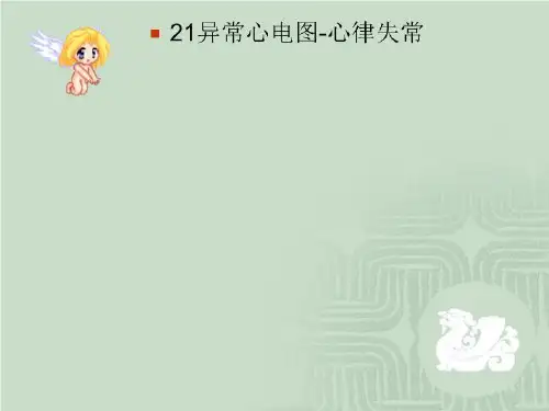21异常心电图-心律失常