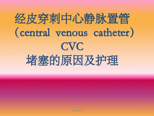 经皮穿刺中心静脉置管