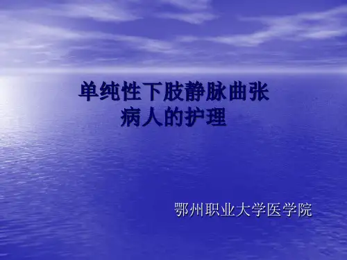 单纯性下肢静脉曲
