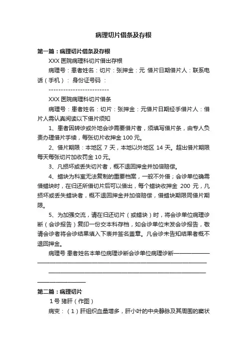 病理切片借条及存根