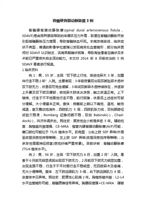 脊髓硬脊膜动静脉瘘3例
