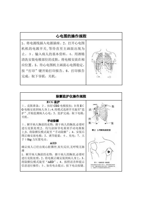 心电图的操作规程