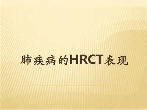 肺疾病的HRCT表现