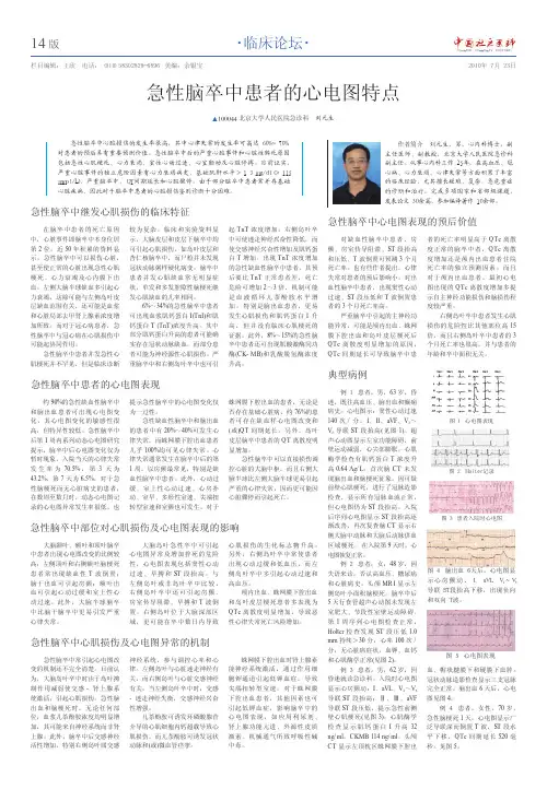 急性脑卒中患者的心电图特点